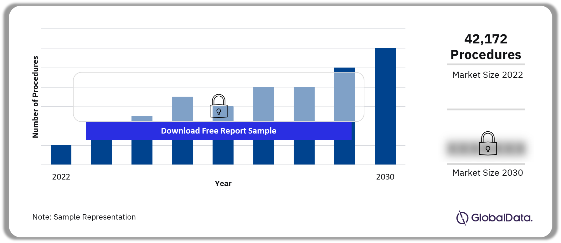 EU5 Neuromodulation Procedures Market Outlook 2022-2030 (Number of Procedures)