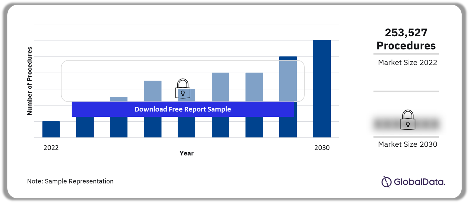 North America Neuromodulation Procedures Market Outlook 2022-2030 (Number of Procedures)