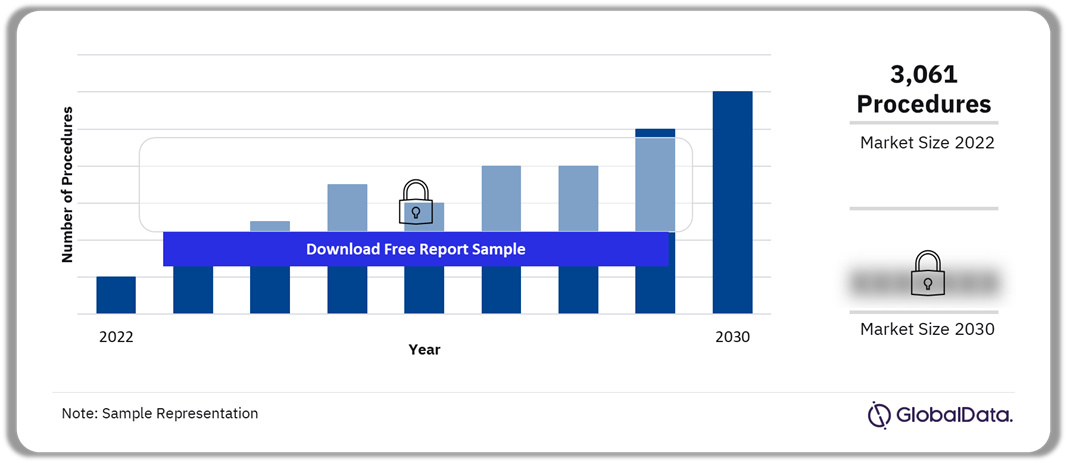 Spain Neuromodulation Procedures Market Outlook 2022-2030 (Number of Procedures)