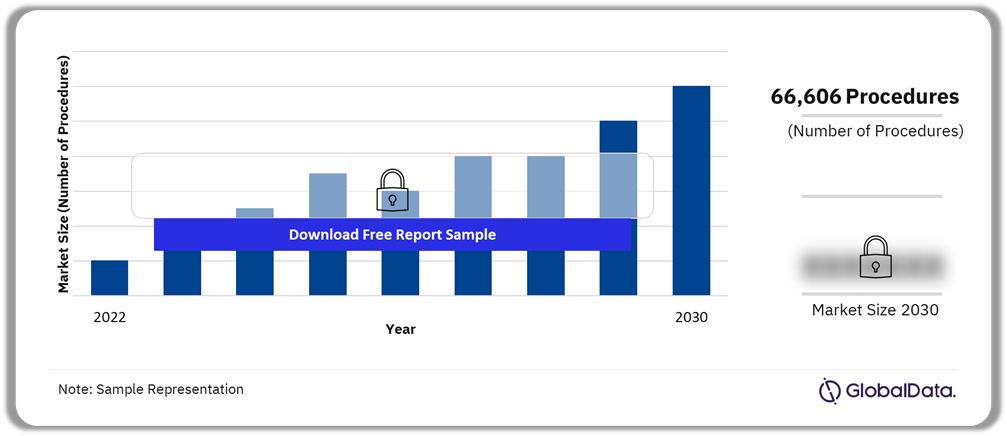 US Neurovascular Thrombectomy Procedures Market Outlook, 2022-2030 (Number of Procedures)