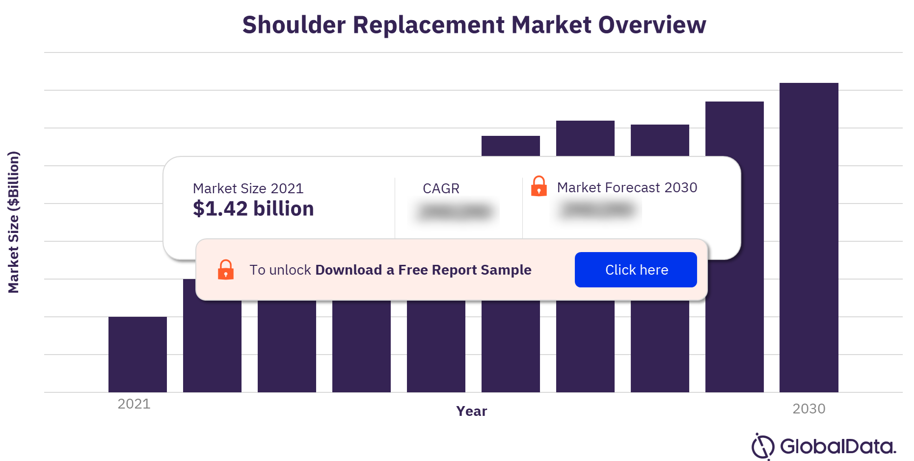 Shoulder replacement market outlook 