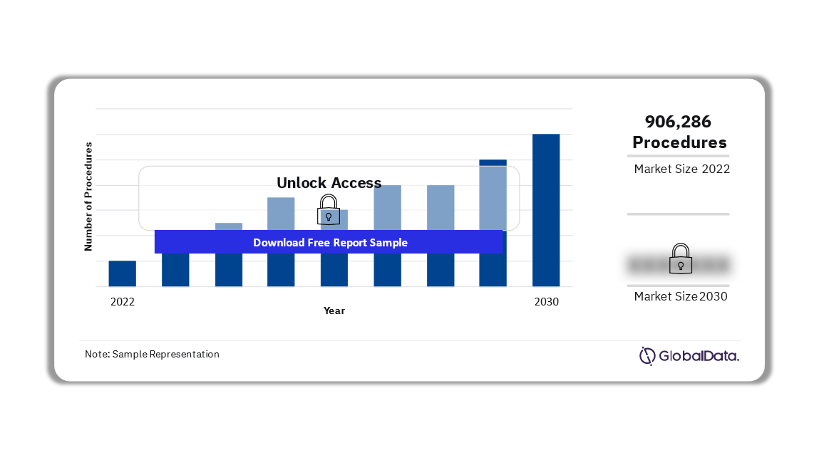 China Urinary Tract Stenting Procedures Market Outlook 2022-2030 (No. of Procedures)