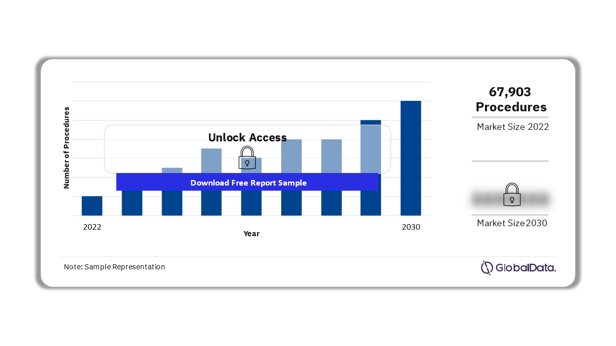 Spain Urinary Tract Stenting Procedures Market Outlook 2022-2030 (No. of Procedures)