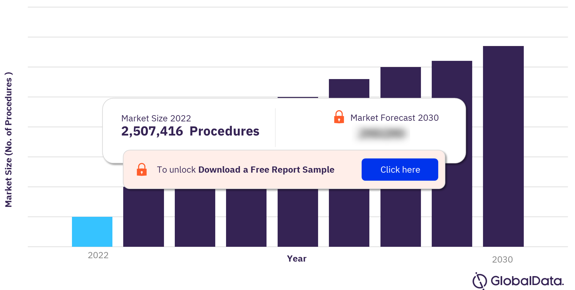 APAC Urinary Tract Stenting Procedures Market Outlook, 2022-2030 (No. of Procedures)