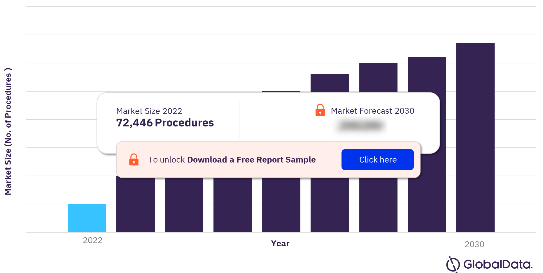 Spain Nephrolithiasis Procedures Market Outlook, 2022-2030 (No. of Procedures)