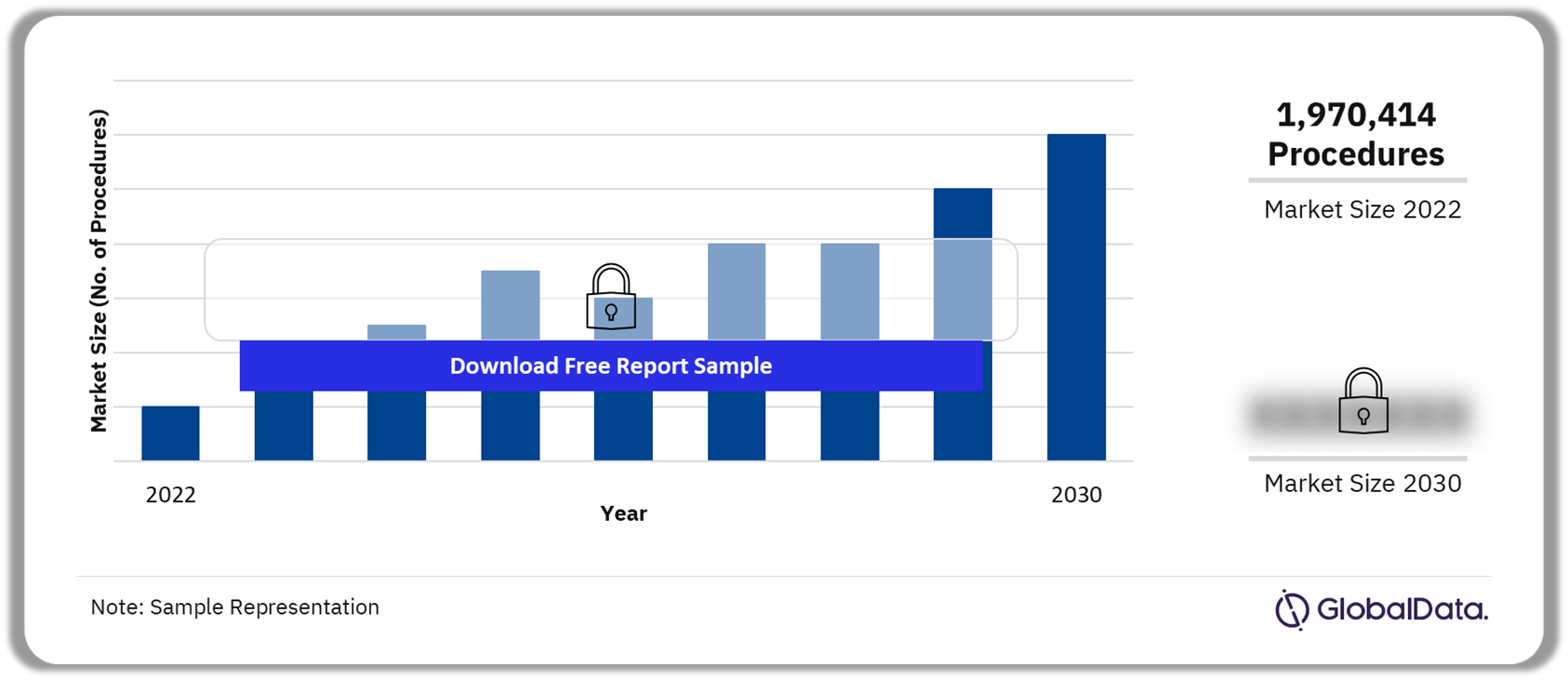 France Ophthalmic Procedures Market Outlook 2022-2030 (Number of Procedures)