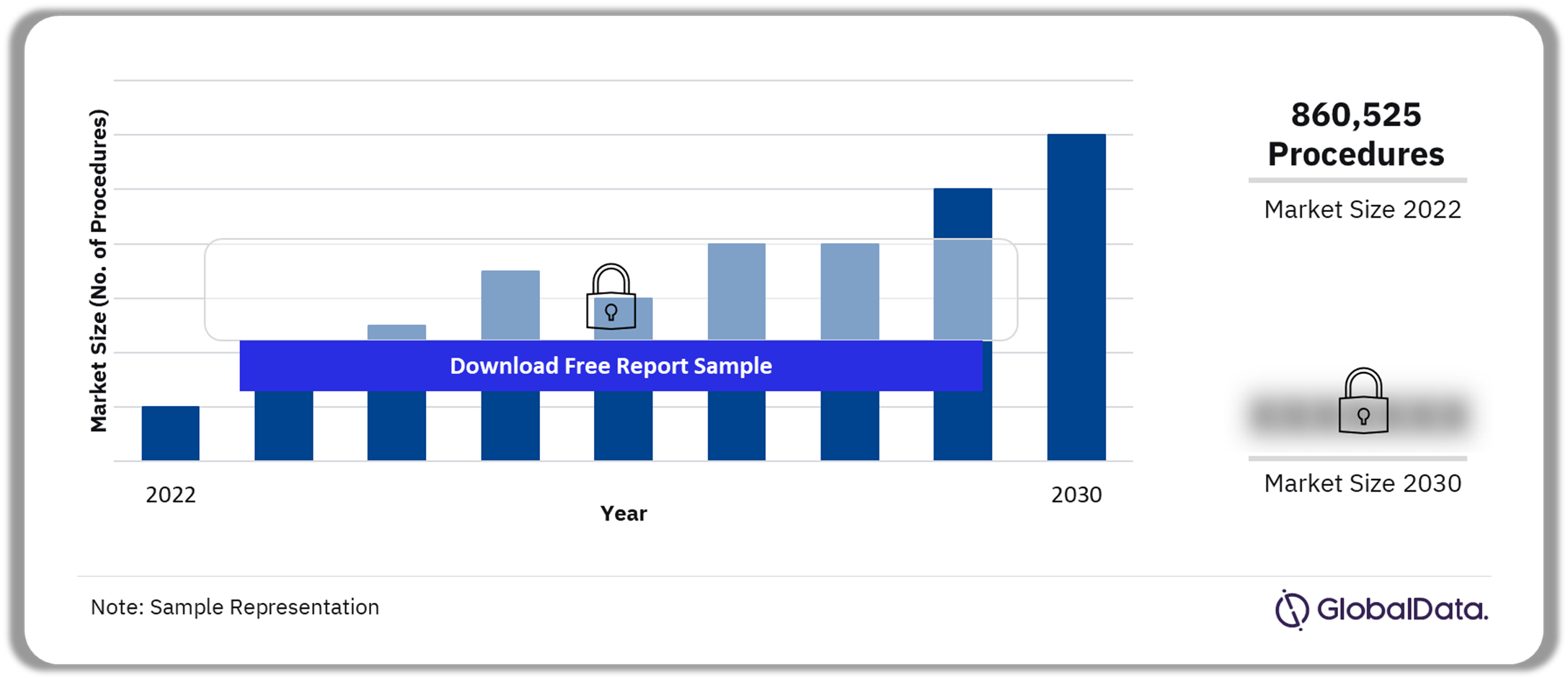 Mexico Ophthalmic Procedures Market Outlook 2022-2030 (Number of Procedures)